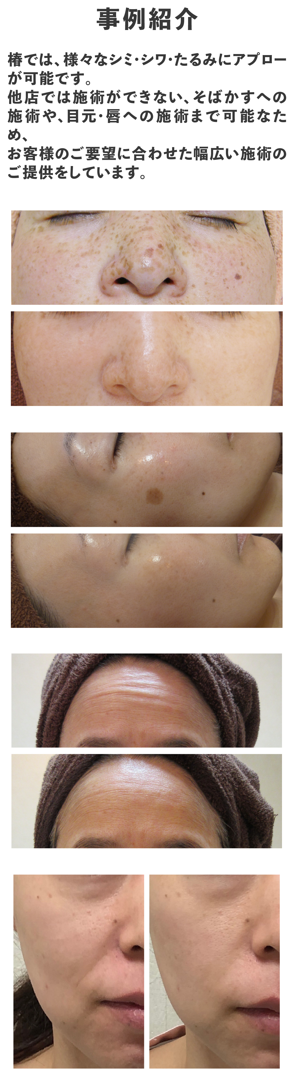 エレクトロポレーションはこんな方におすすめ