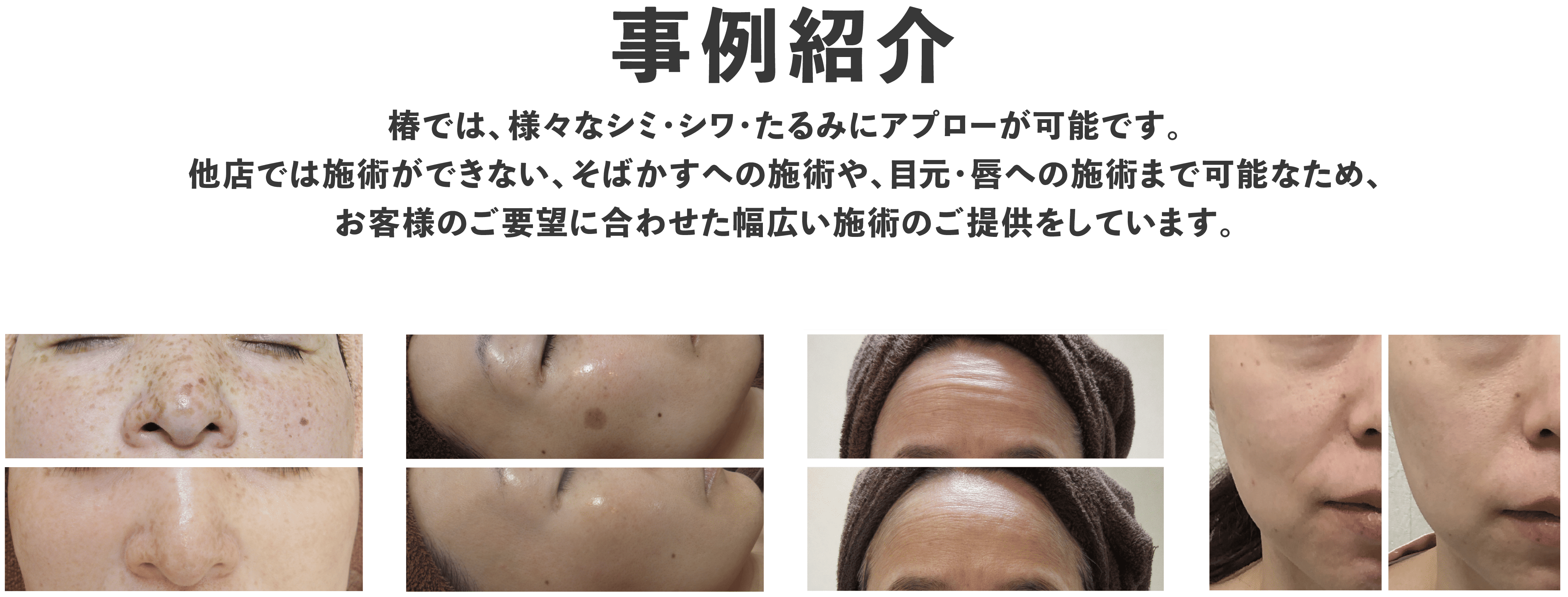 エレクトロポレーションはこんな方におすすめ