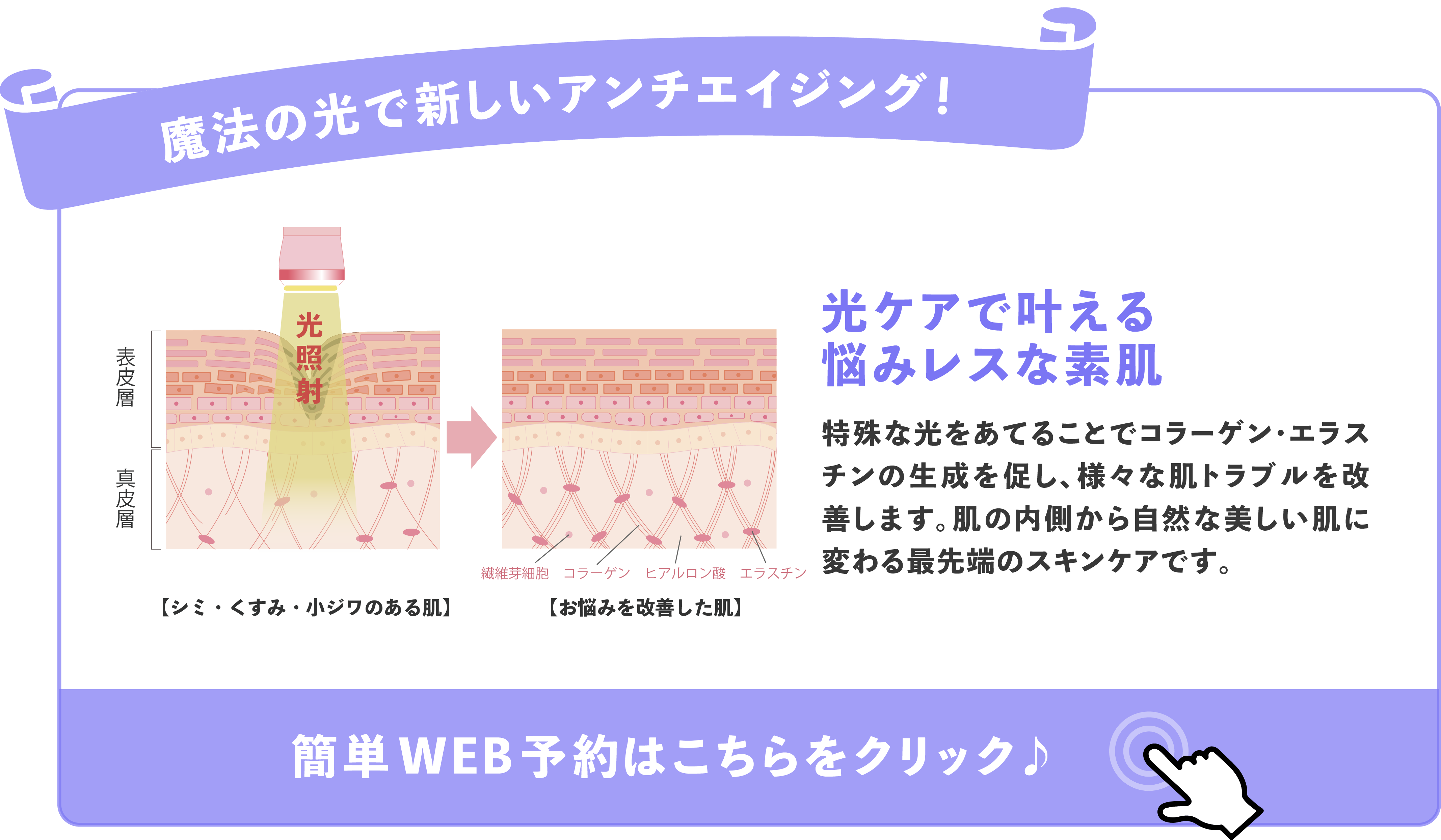 魔法の光で新しいアンチエイジング