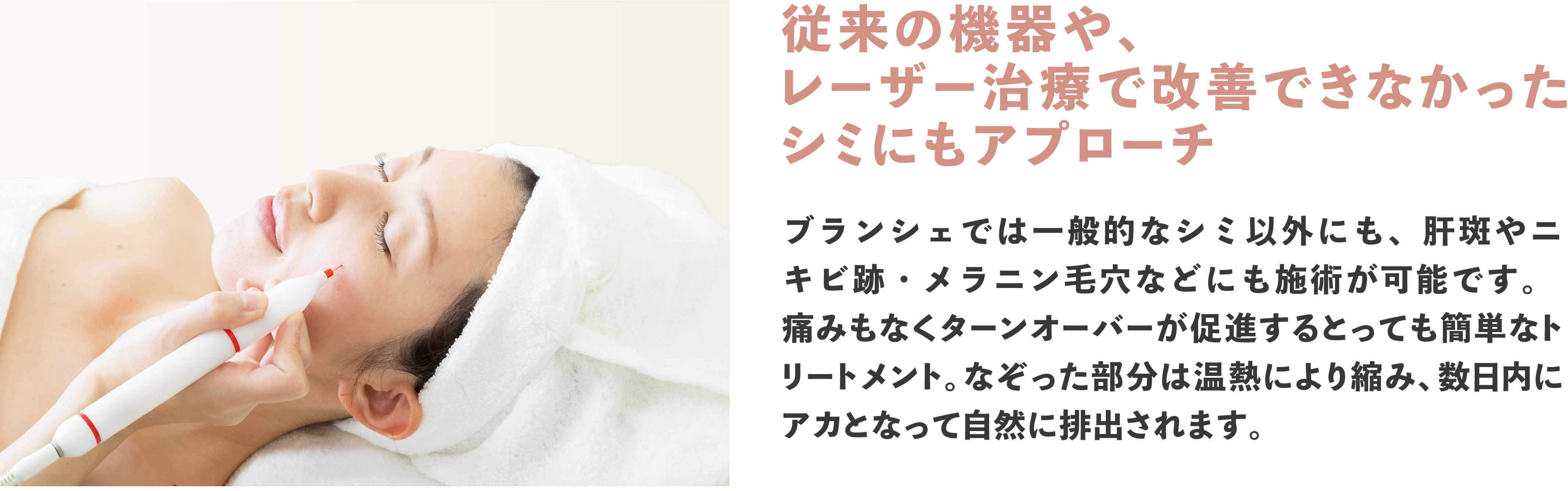 従来の機器や、レーザー治療で改善できなかったシミにもアプローチ