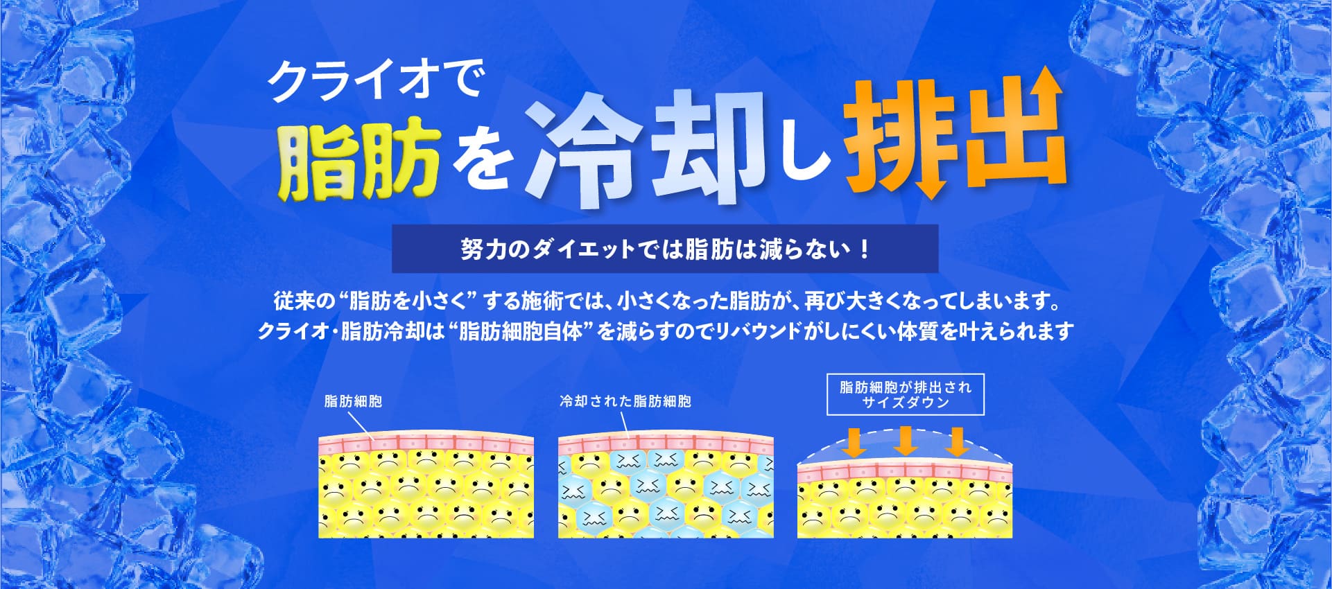 クライオで脂肪を冷却し排出