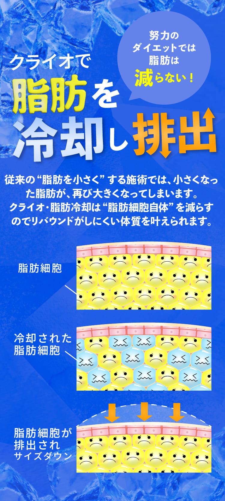 クライオで脂肪を冷却し排出