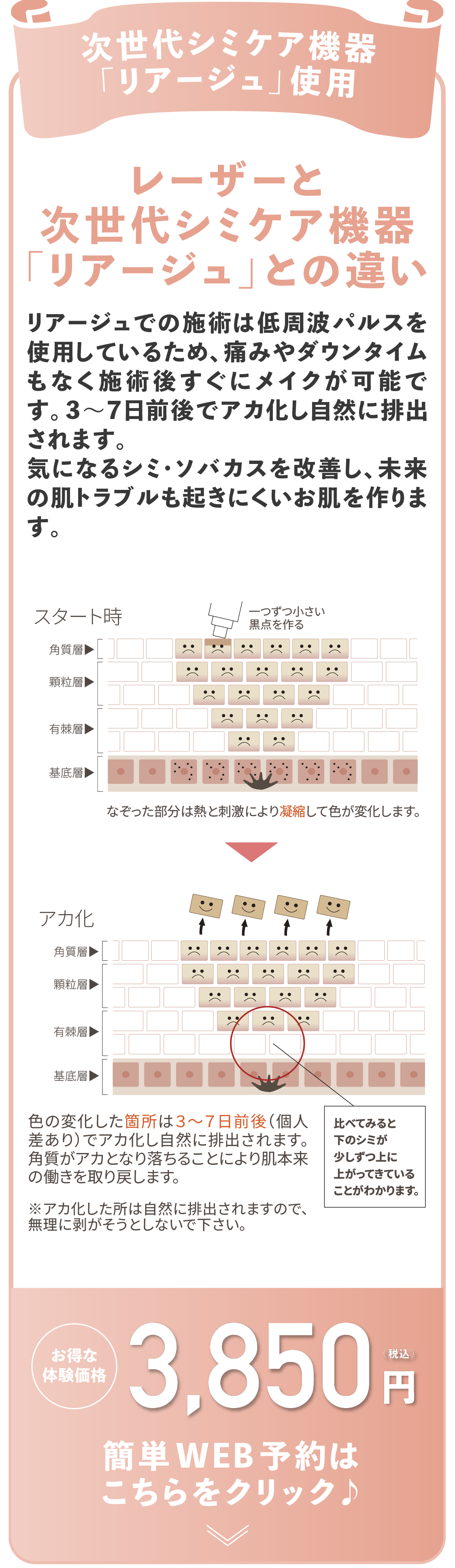 レーザーと次世代シミケア機器「リアージュ」との違い