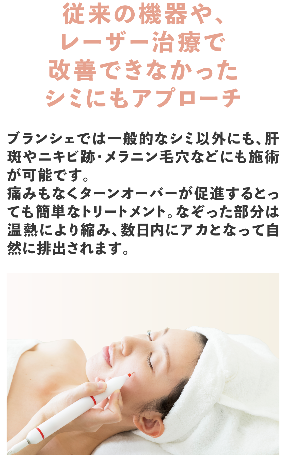 従来の機器や、レーザー治療で改善できなかったシミにもアプローチ